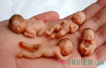Nạo phá thai và những hậu quả khó lường